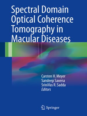 cover image of Spectral Domain Optical Coherence Tomography in Macular Diseases